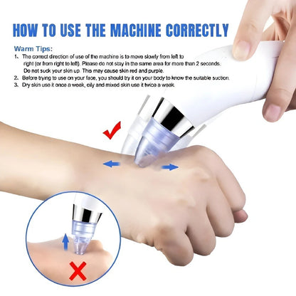 Black Head Remover Machine 4 in 1