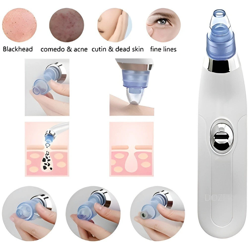 Black Head Remover Machine 4 in 1