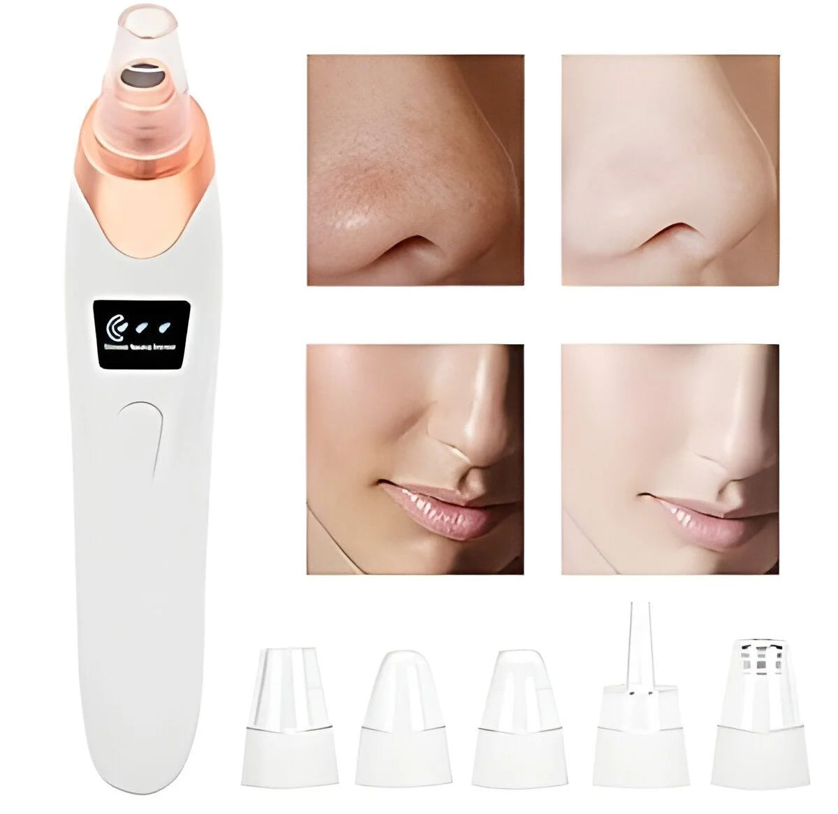 5 in 1 Electric Blackhead Remover Machine